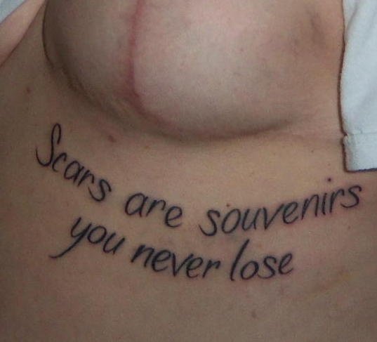 Cicatrizes são souvenirs que você nunca perde